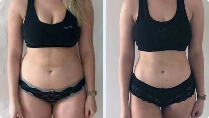 Transformación Carga 2